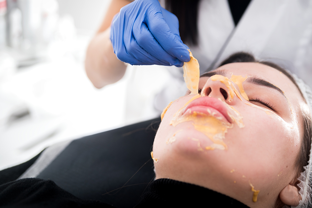 Chemical Peel Treatment For Facials In Civil Lines, Gujranwala